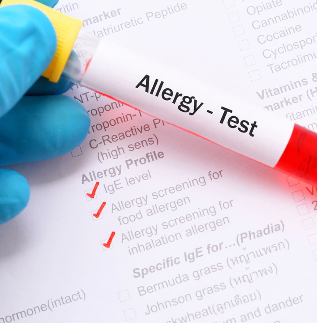 Intolerance Testing